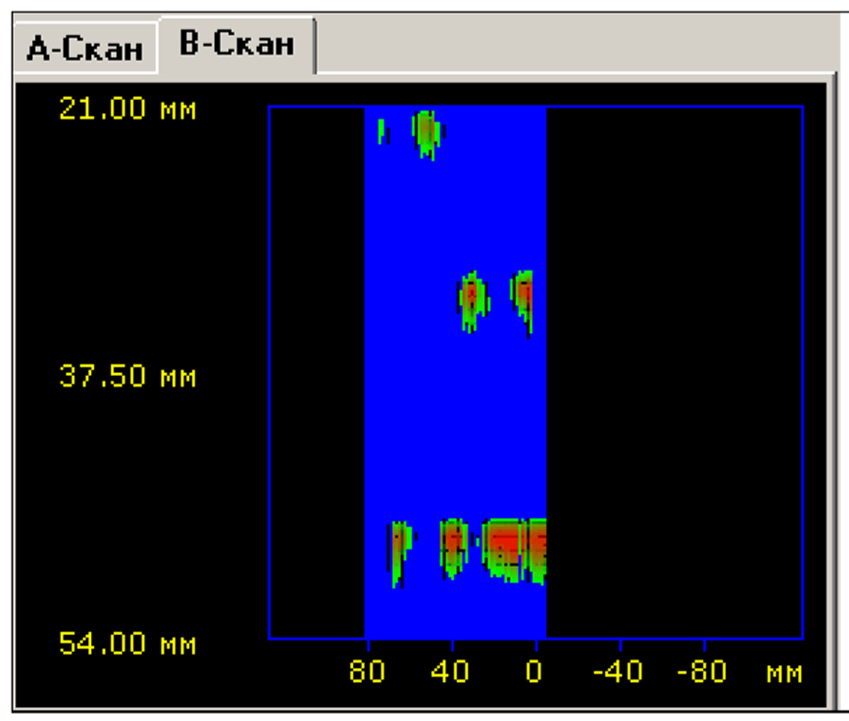 B-scan